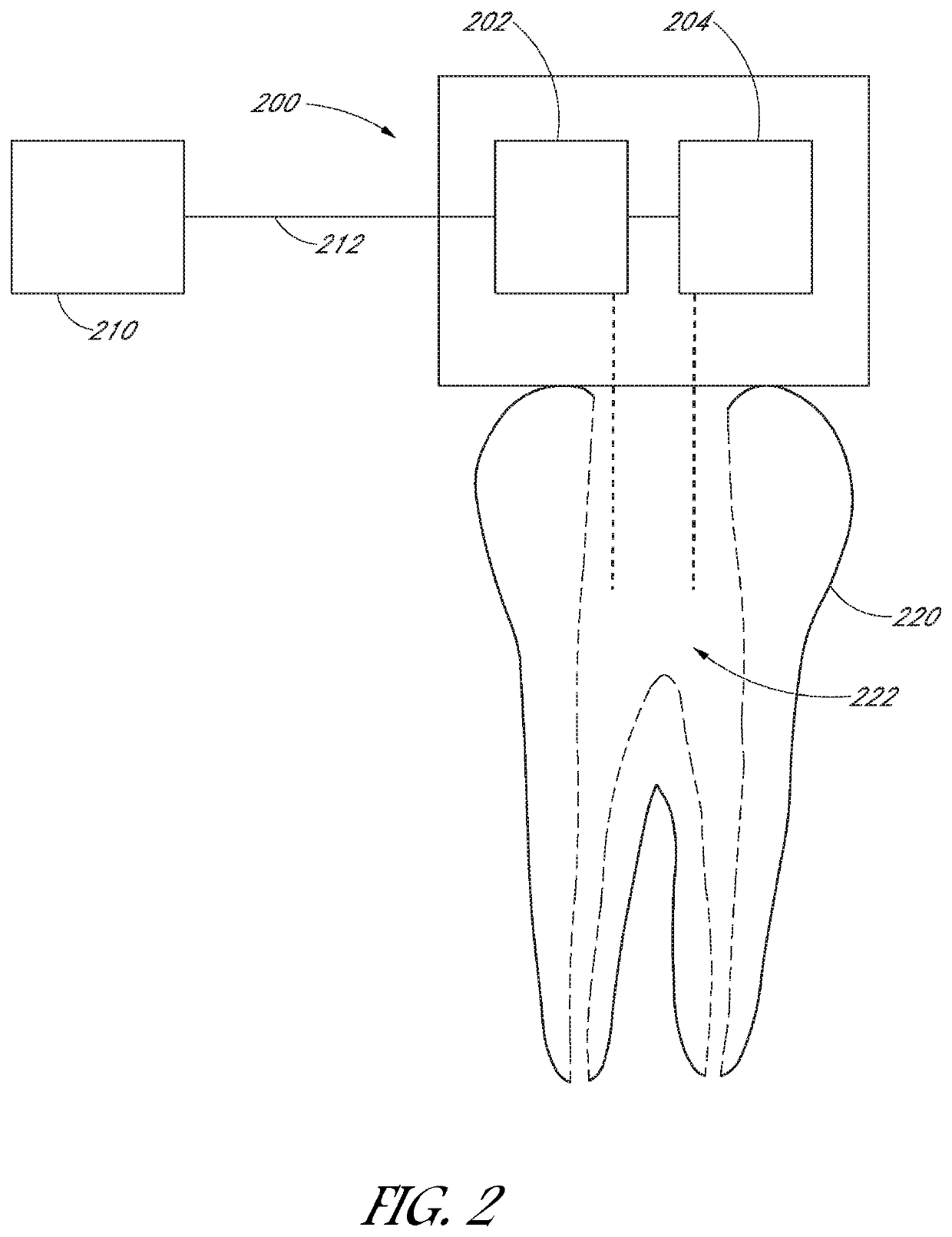 Apparatus and method for treating teeth