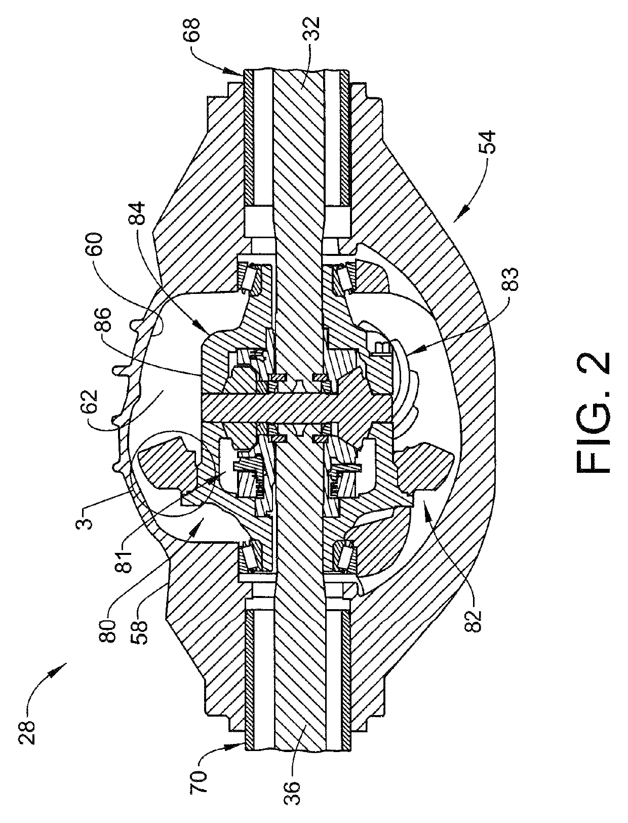 Vehicle differential