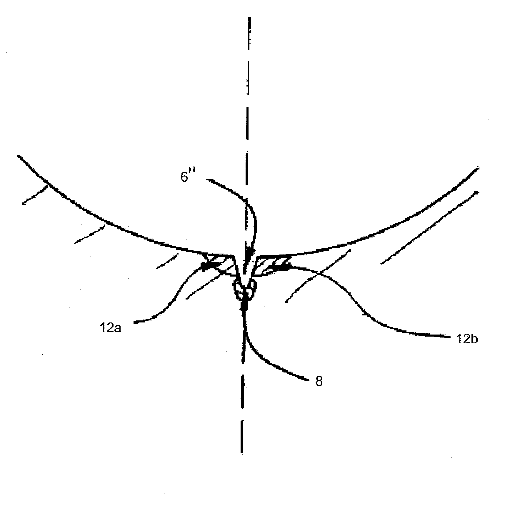 Method and Device for the Fracture Separation of Workpieces