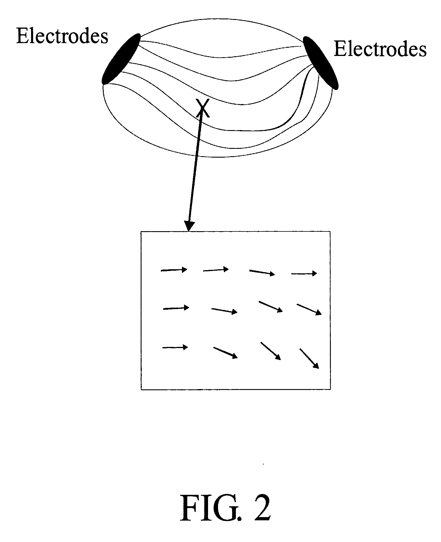 Current density impedance imaging (CDII)