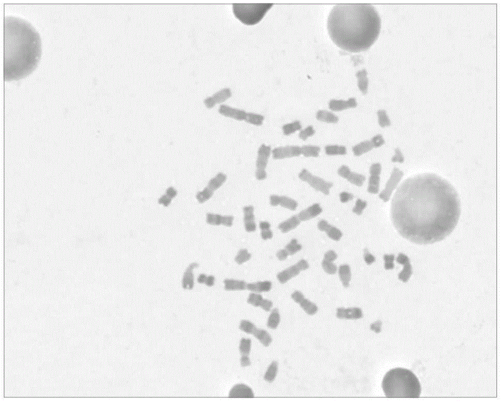 Preparation method of chromosome R banding