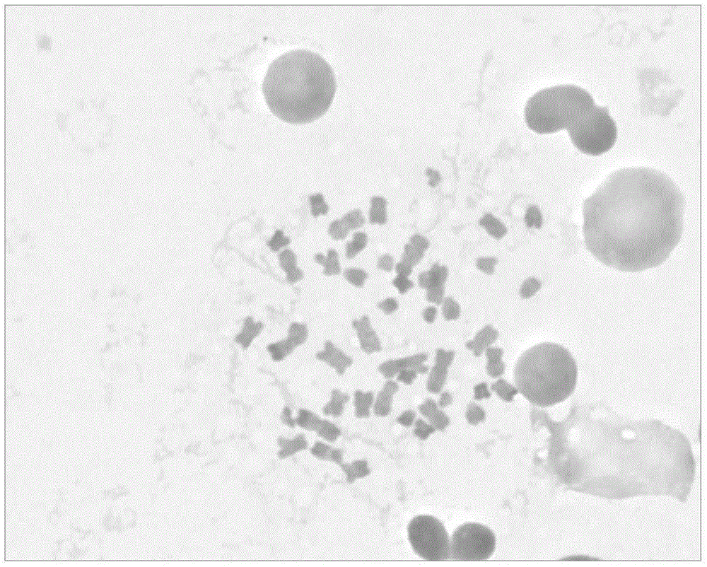 Preparation method of chromosome R banding