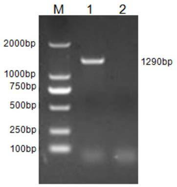 Siniperca chuatsi ranairidovirus and rhabdovirus duplex PCR detection kit and detection method