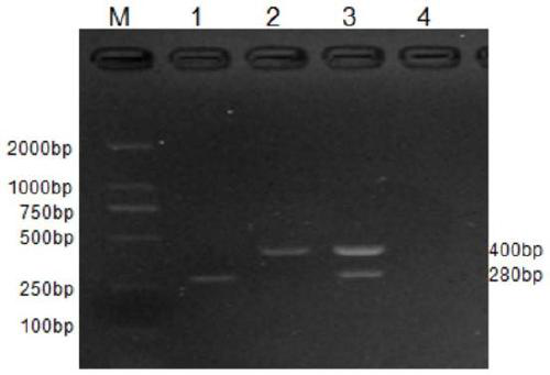 Siniperca chuatsi ranairidovirus and rhabdovirus duplex PCR detection kit and detection method