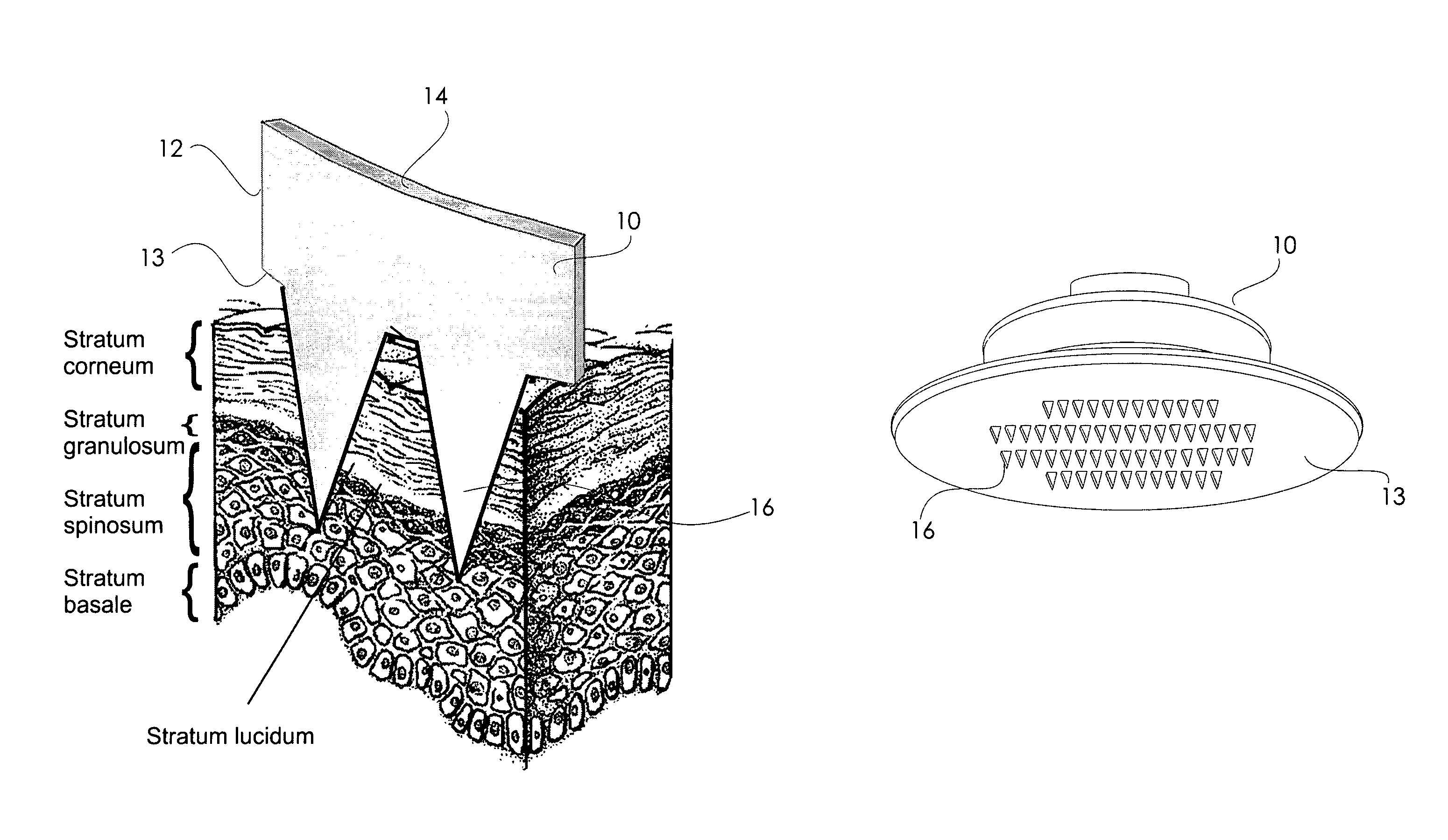 Physiological recording device or electrode