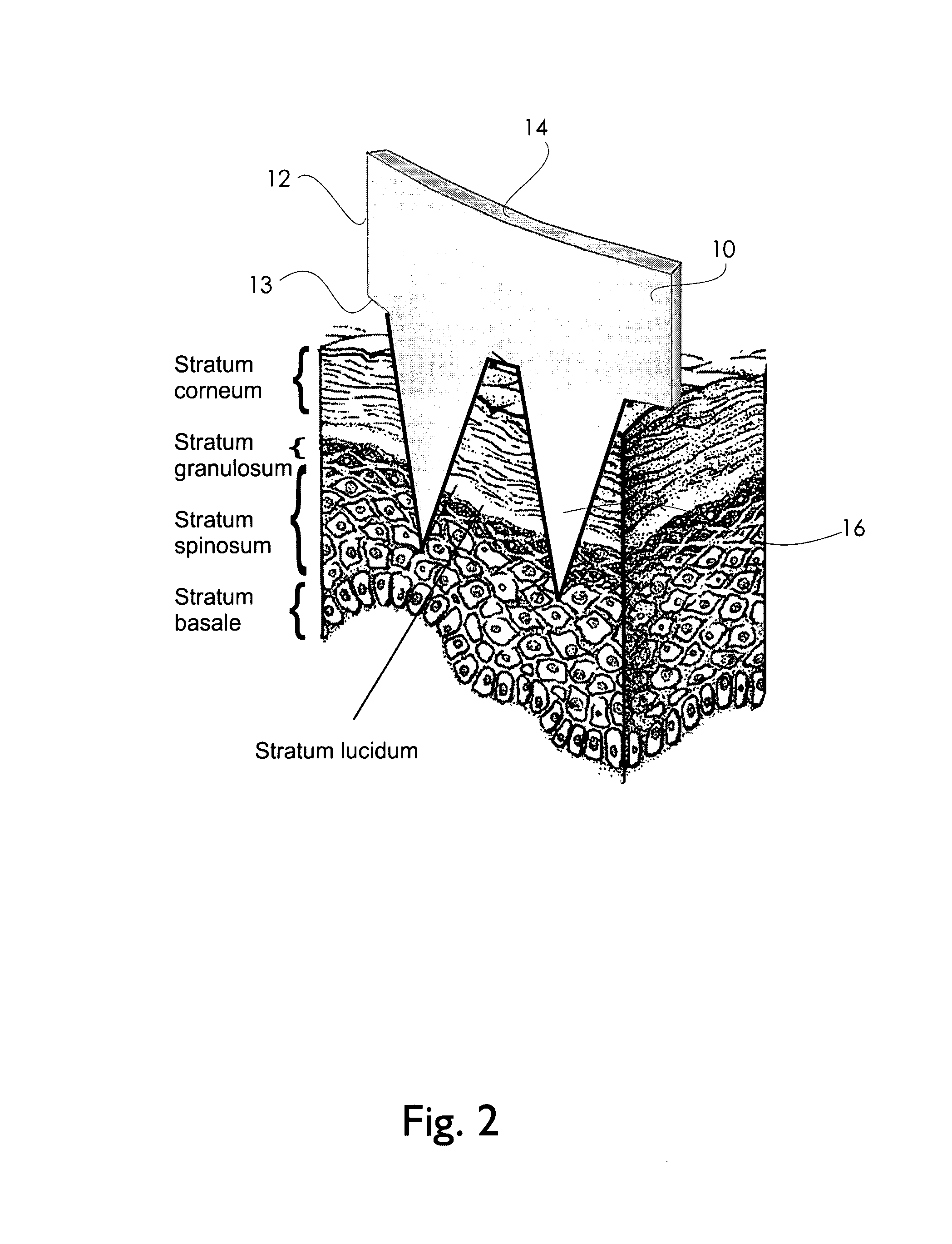 Physiological recording device or electrode