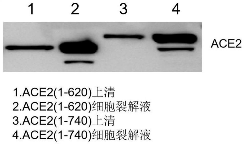 AAV vector based generic gene therapy drug for coronavirus infection and preparation method thereof