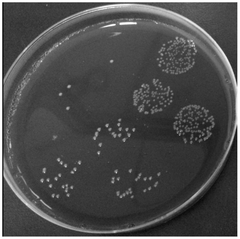 Application of bacteroides fragilis and extract thereof in preparation of medicine for preventing and treating irritable bowel syndrome