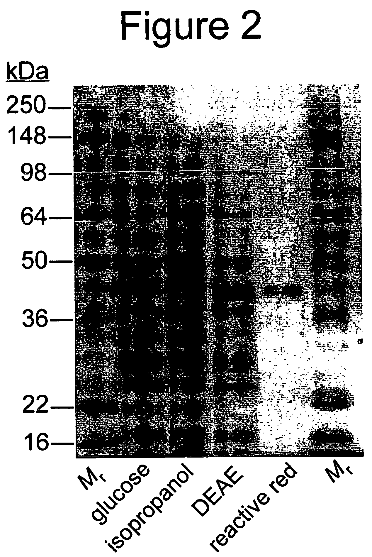 Enzyme-based system and sensor for measuring acetone