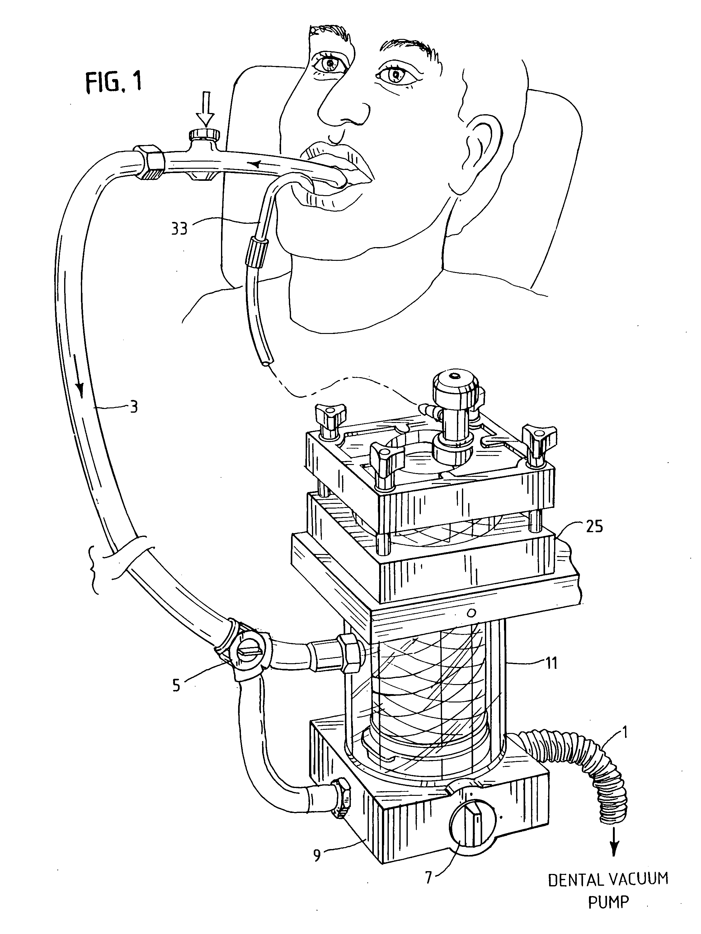 Method and apparatus for removing particulate metals from dental waste water