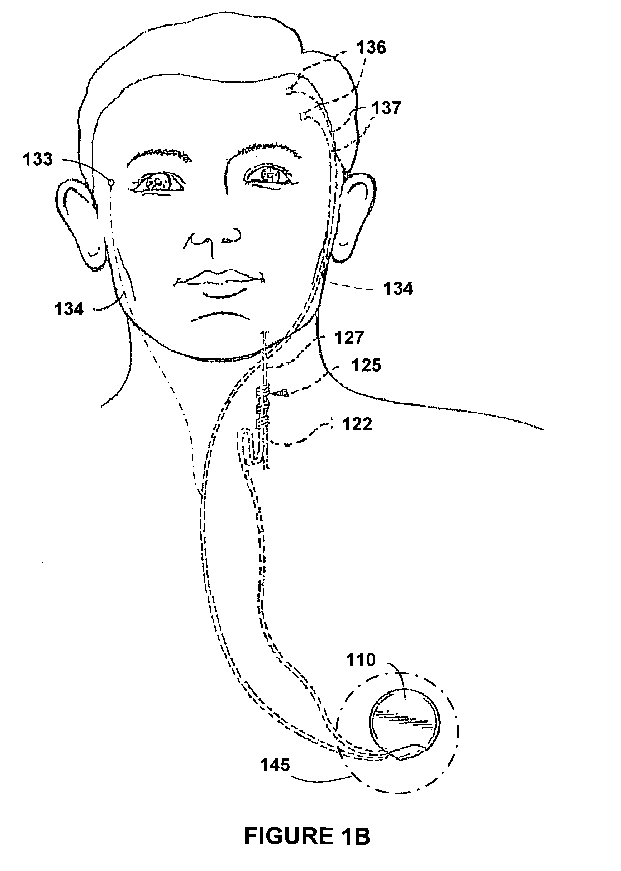 Controlling neuromodulation using stimulus modalities