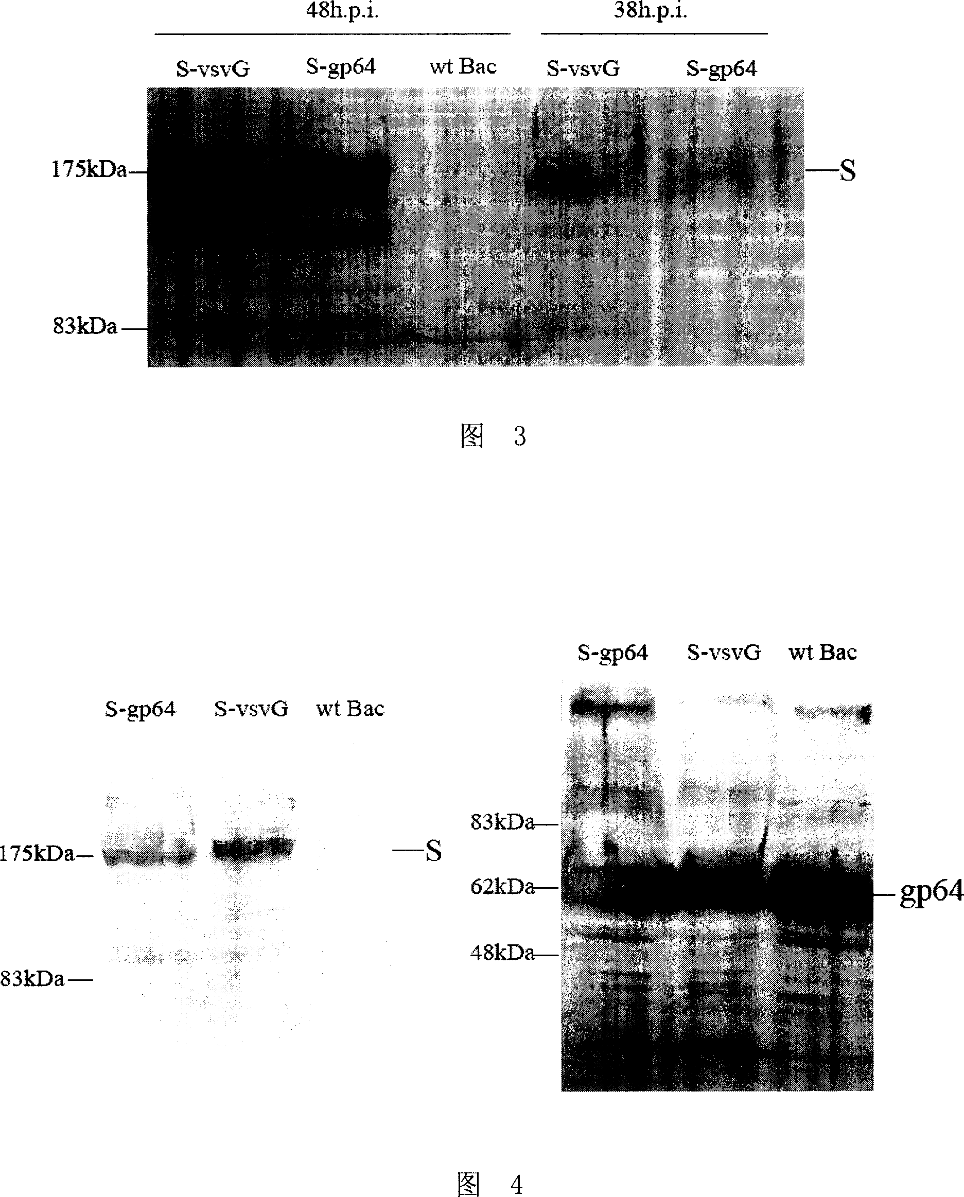 SARS vaccine and its preparation method