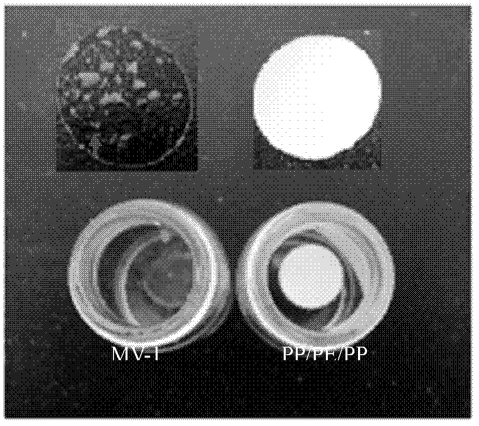 Lithium ion secondary battery containing ion liquid electrolyte