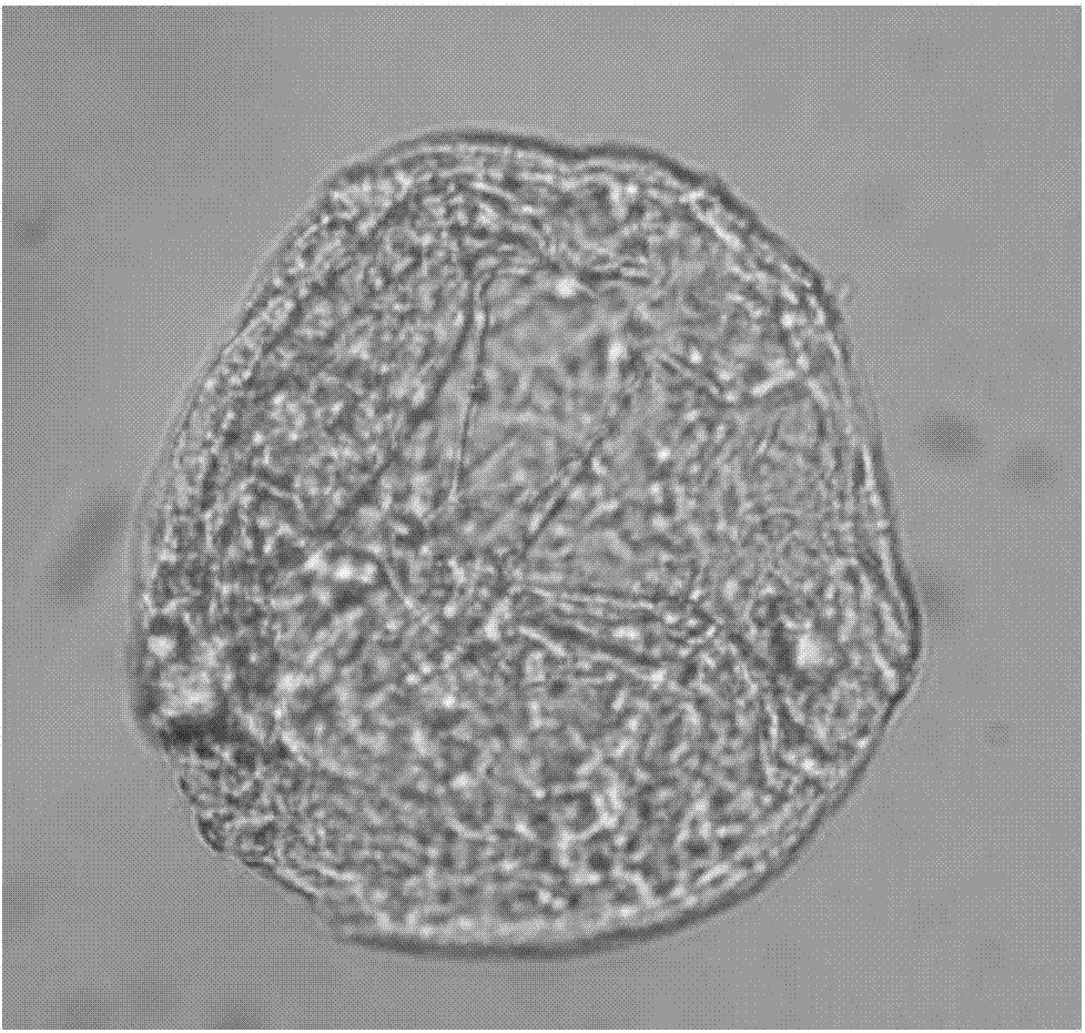 Preparation method of royal jelly microcapsule