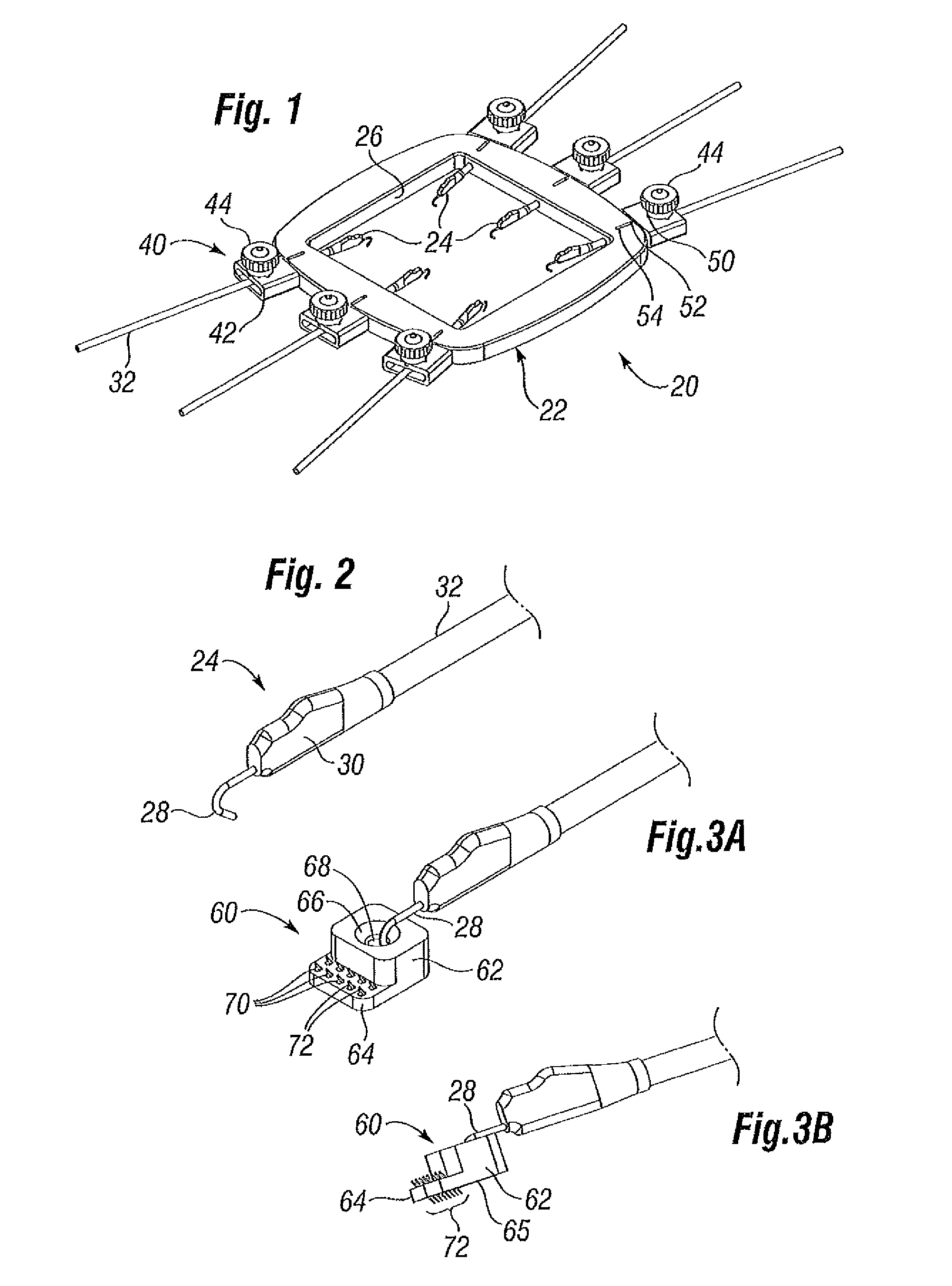 Skin tensioner for hair transplantation