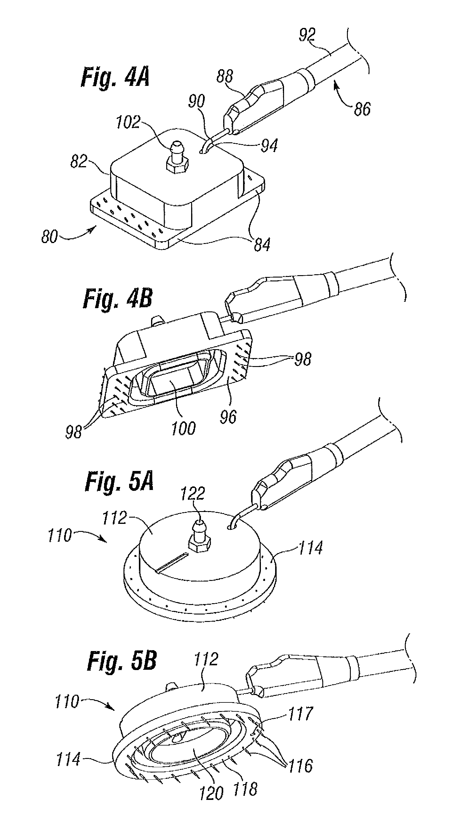 Skin tensioner for hair transplantation