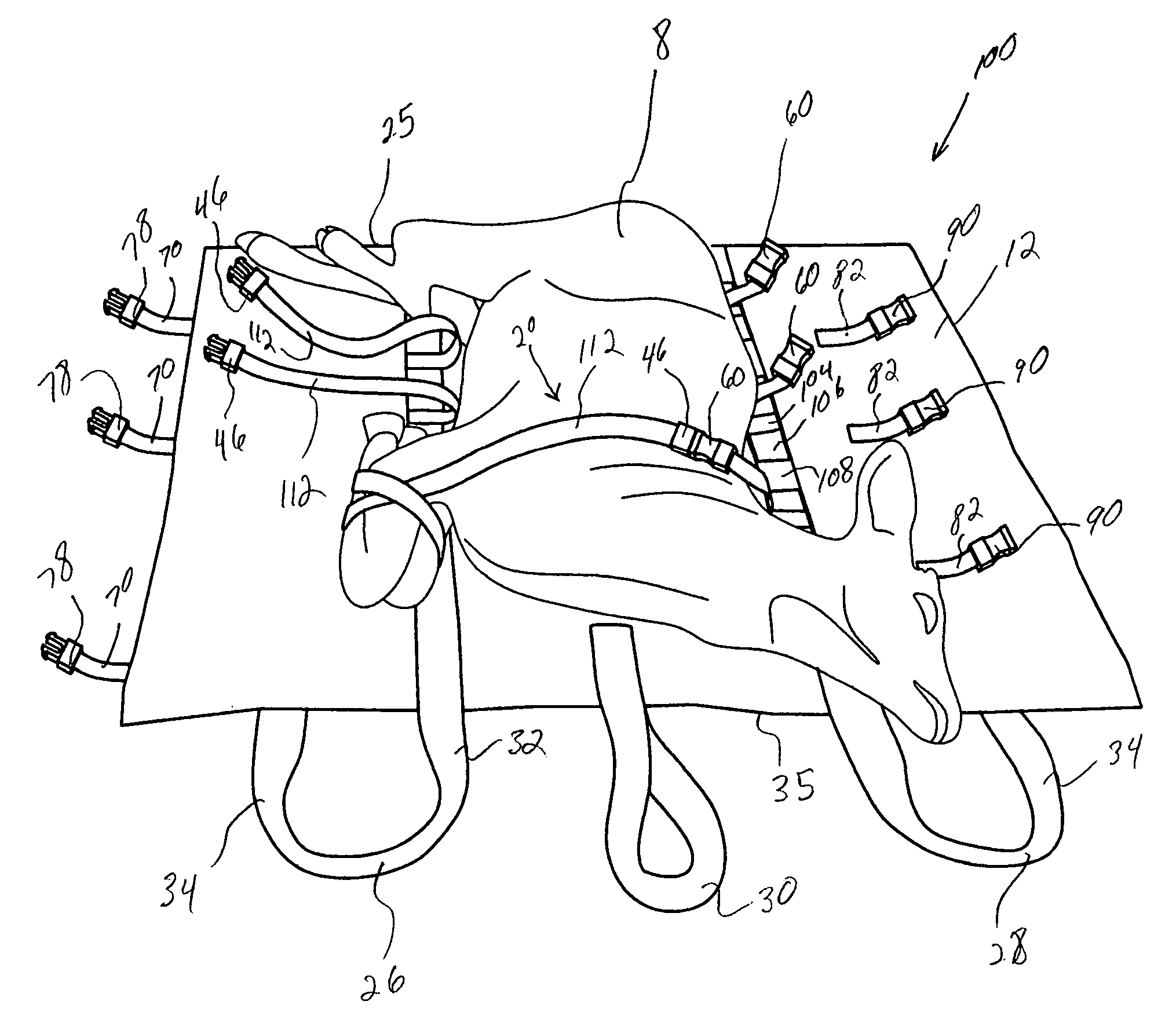 Device for manually transporting a carcass