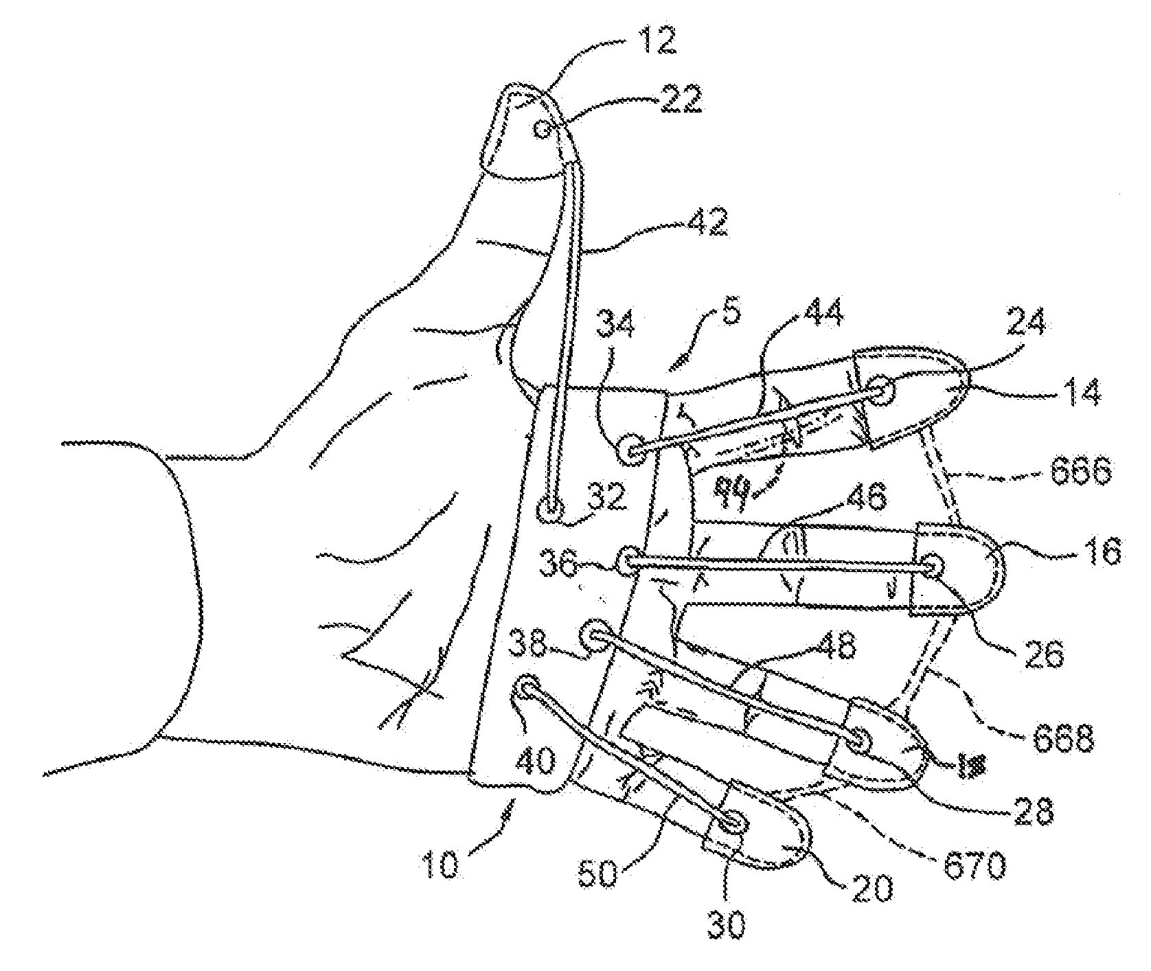 Hand exercising device