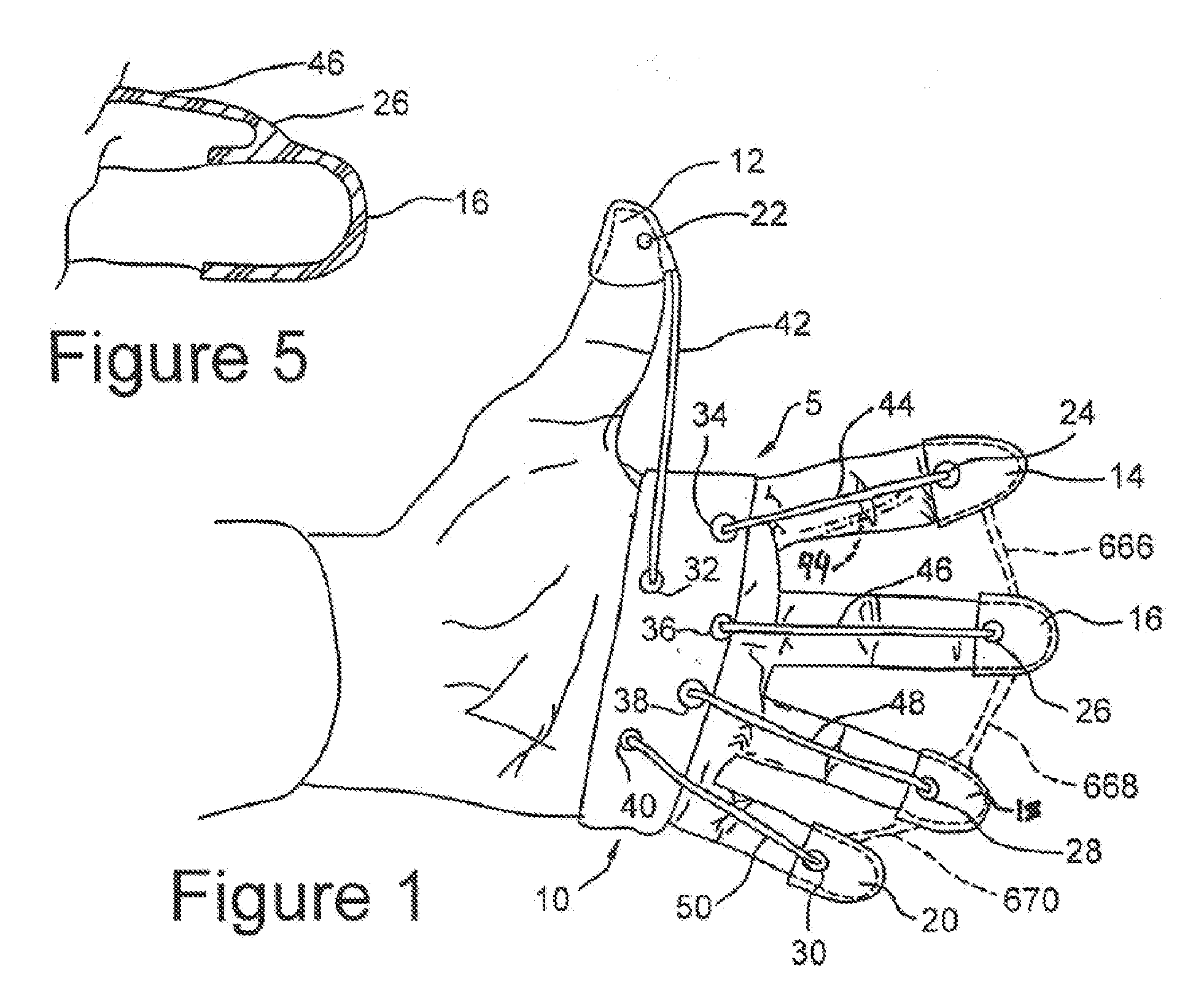 Hand exercising device