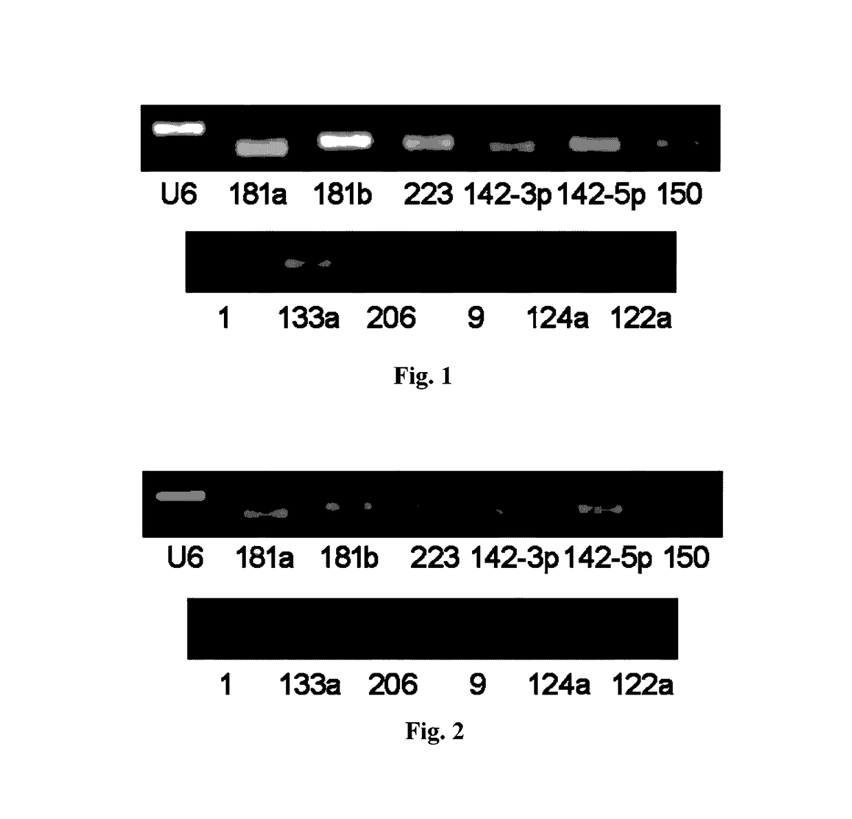 Pancreatic cancer markers, and detecting methods, kits, biochips thereof