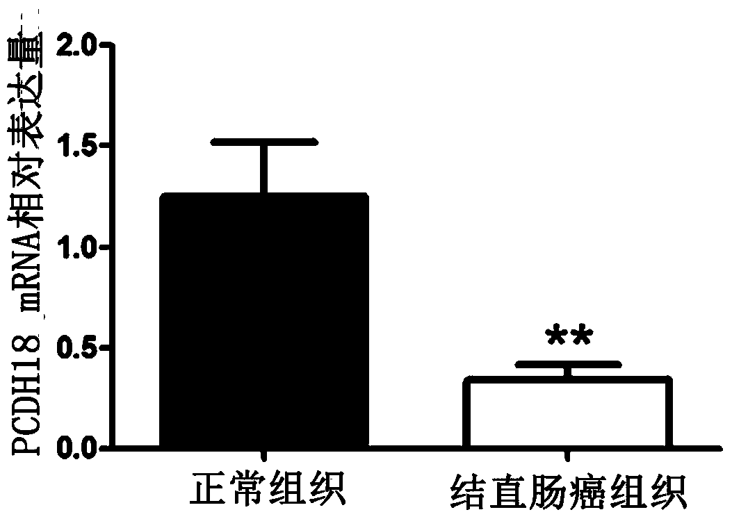 Application of pcdh18 gene in preparation of colorectal cancer diagnostic kit and kit