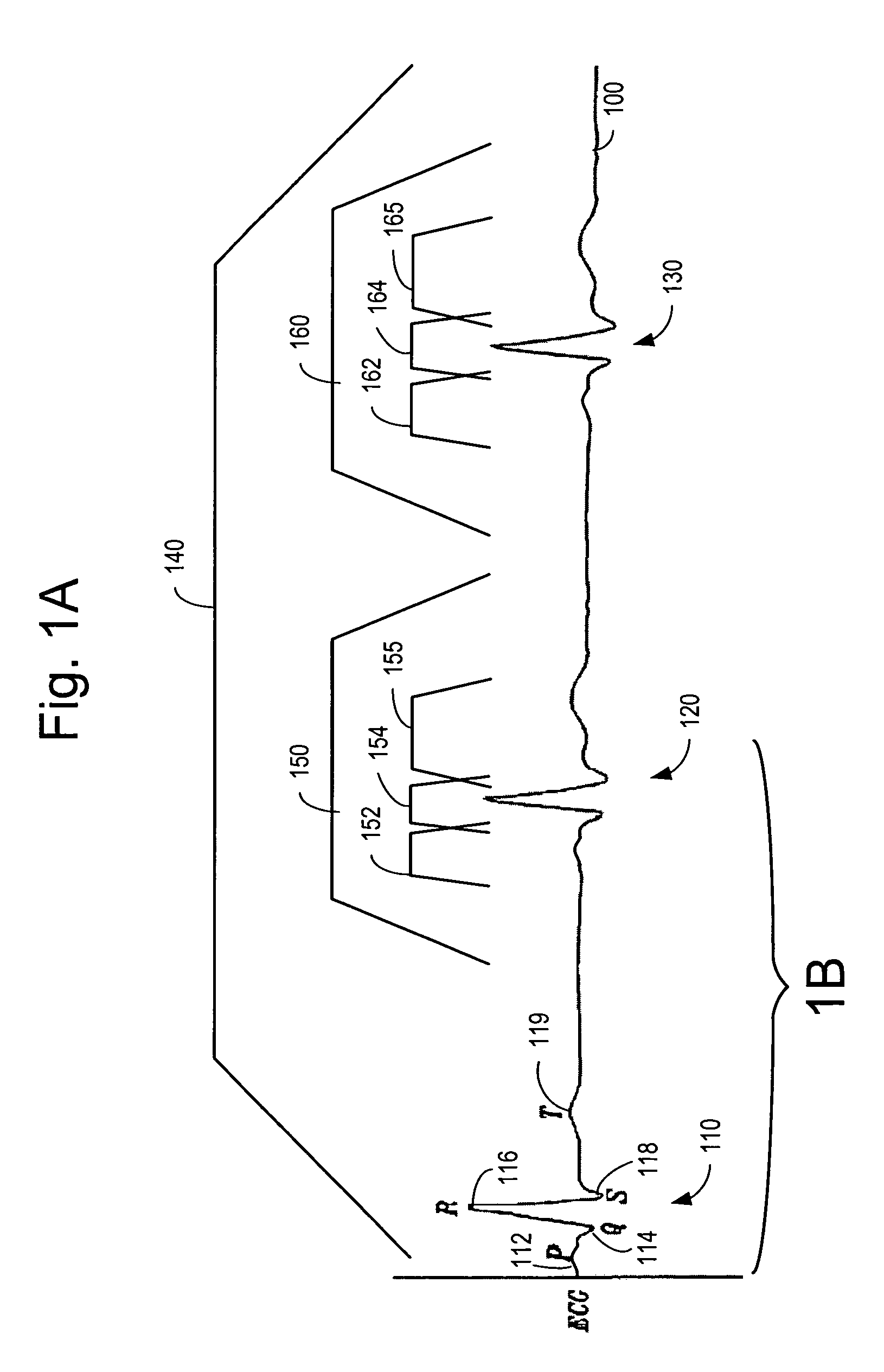 Cardiac activation sequence monitoring for ischemia detection