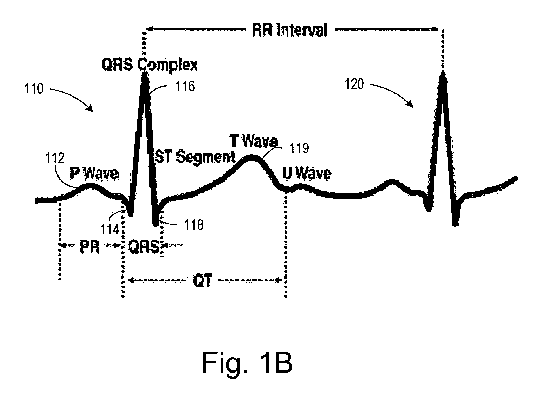 Cardiac activation sequence monitoring for ischemia detection