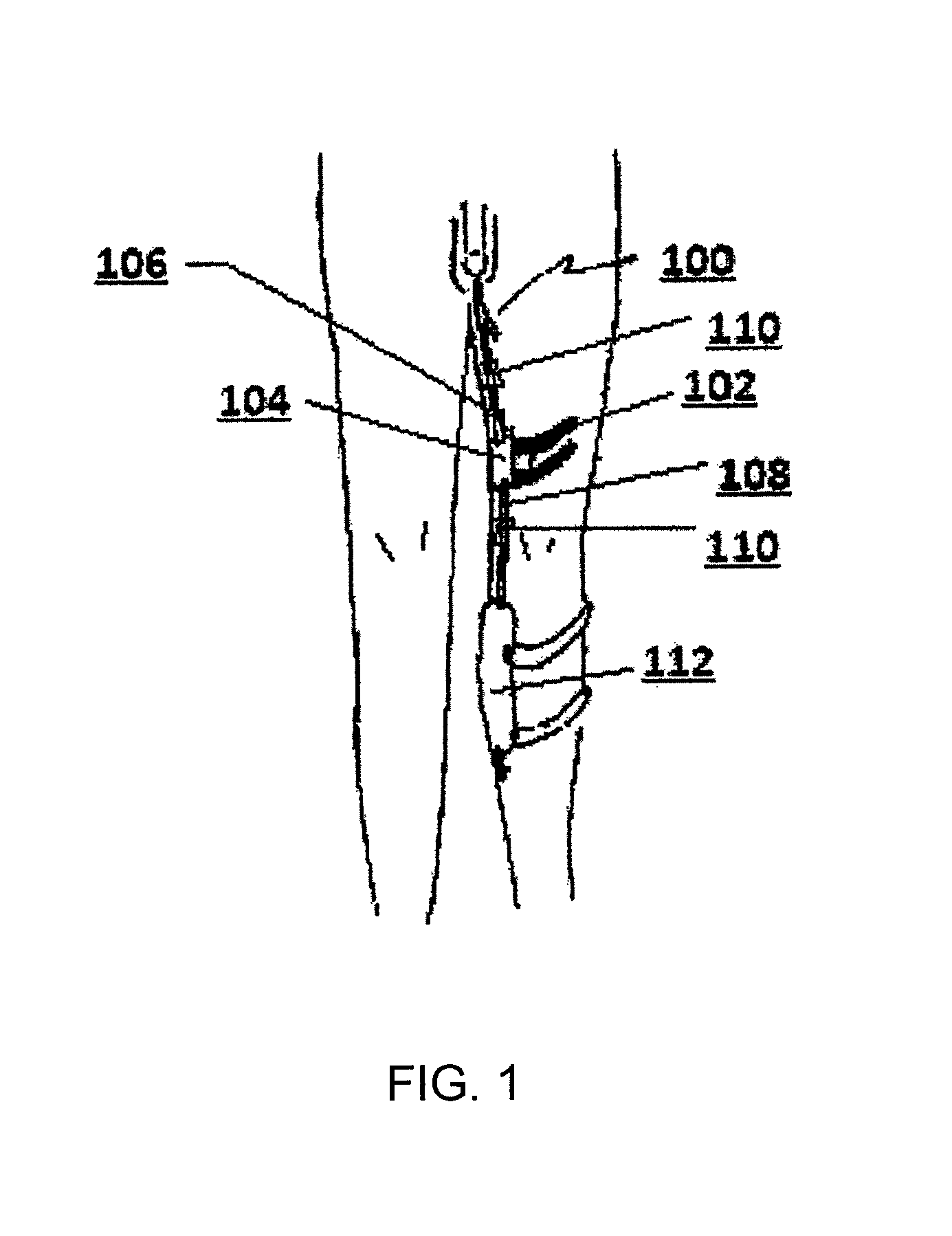 Medical tubing and catheter control