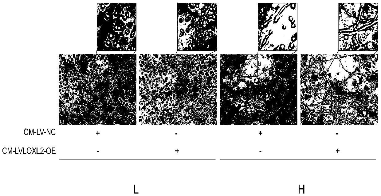 Preparation method of lung hardness base in vitro cell culture platform