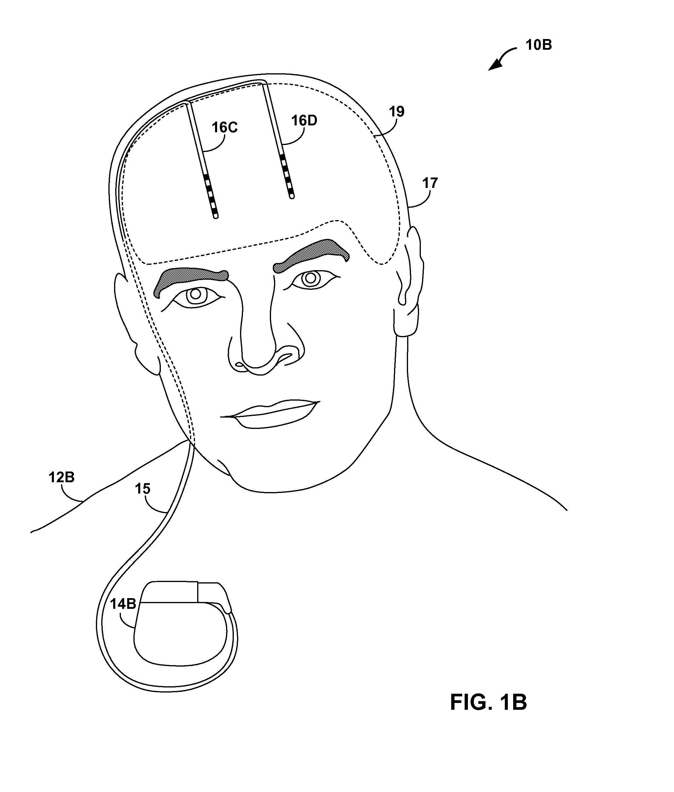 Sensitivity analysis for selecting therapy parameter sets