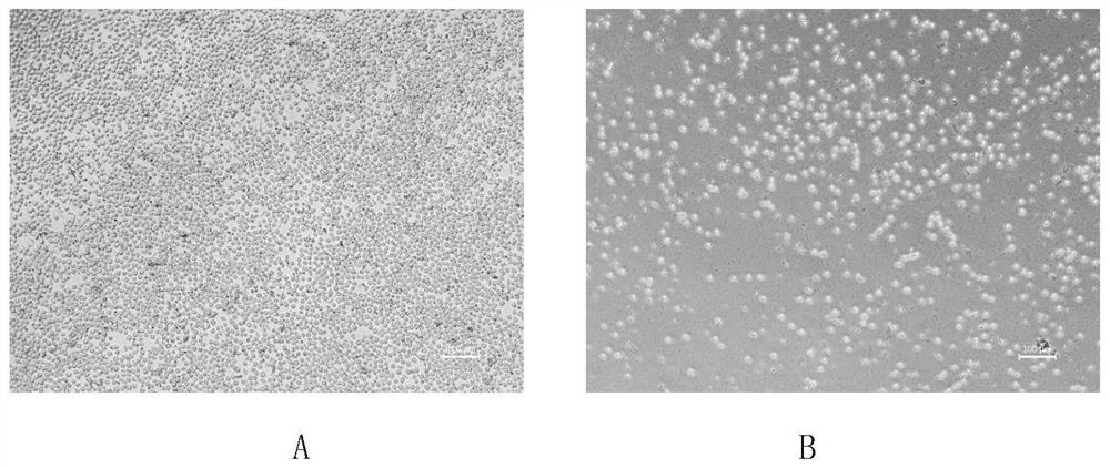 Culture medium and culture method for induced differentiation of CD34+ umbilical cord blood mononuclear cells