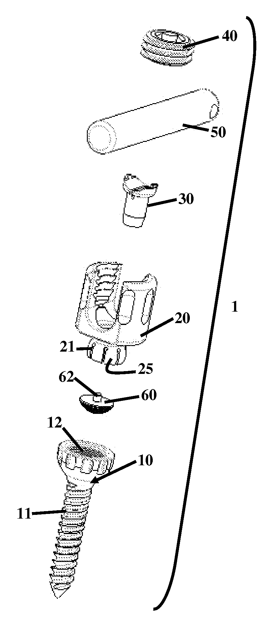 Screw Assembly and Method