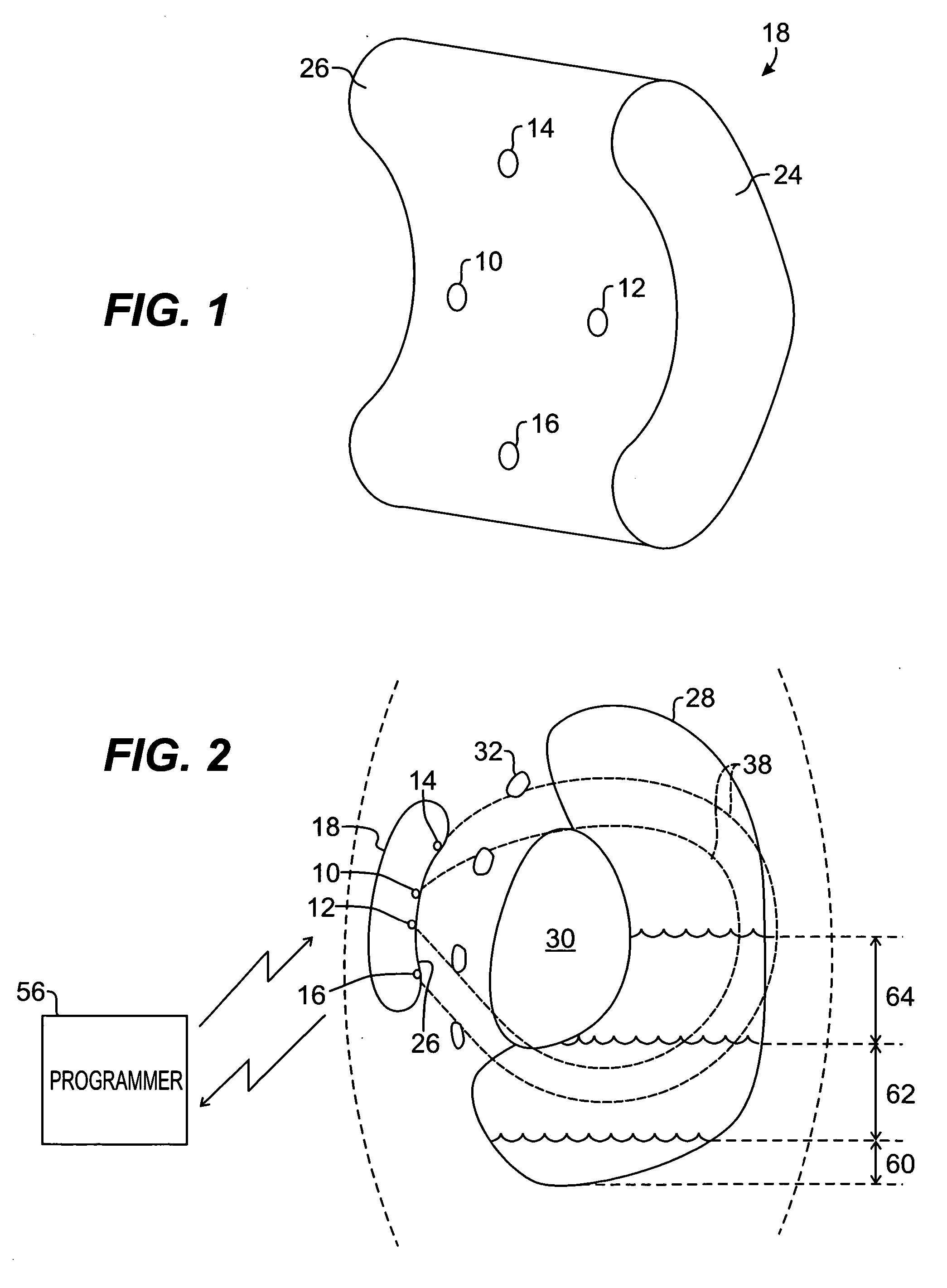 Remote control of implantable device through medical implant communication service band