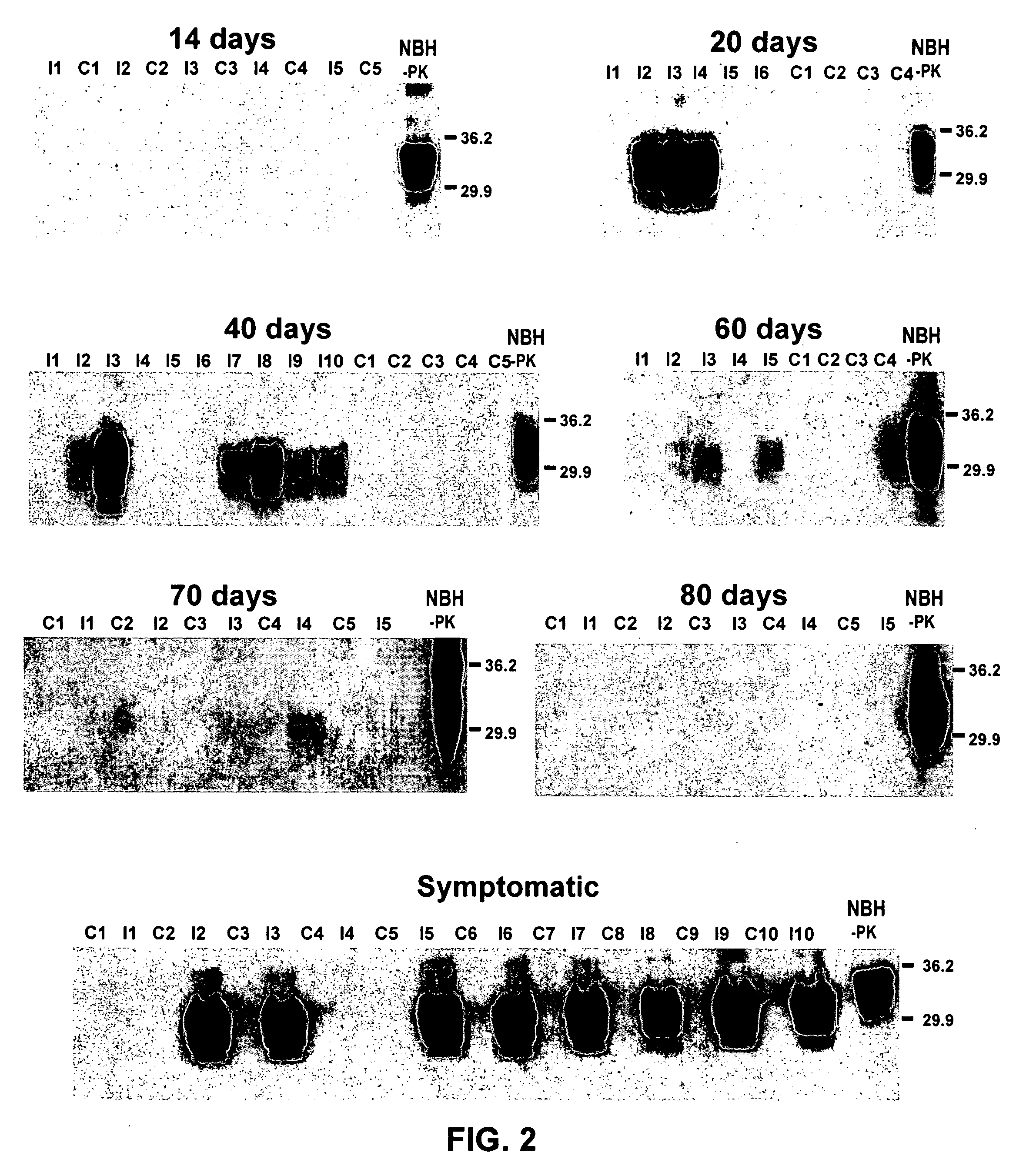 Ultrasensitive detection of prions by automated protein misfolding cyclic amplification