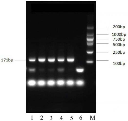 Cerebral stroke LncRNA biomarker and application thereof