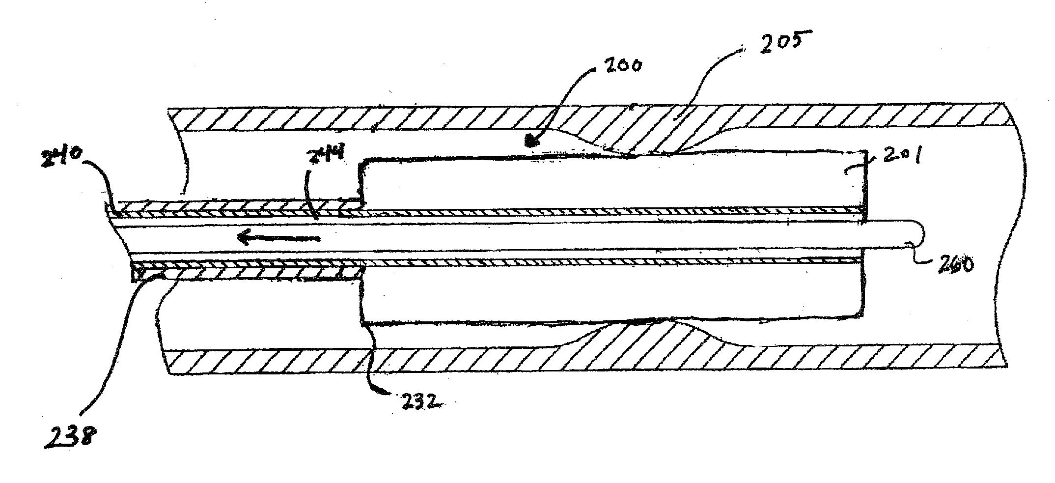 Gastroenterological medical device, in particular stent for the gall or pancreatic duct