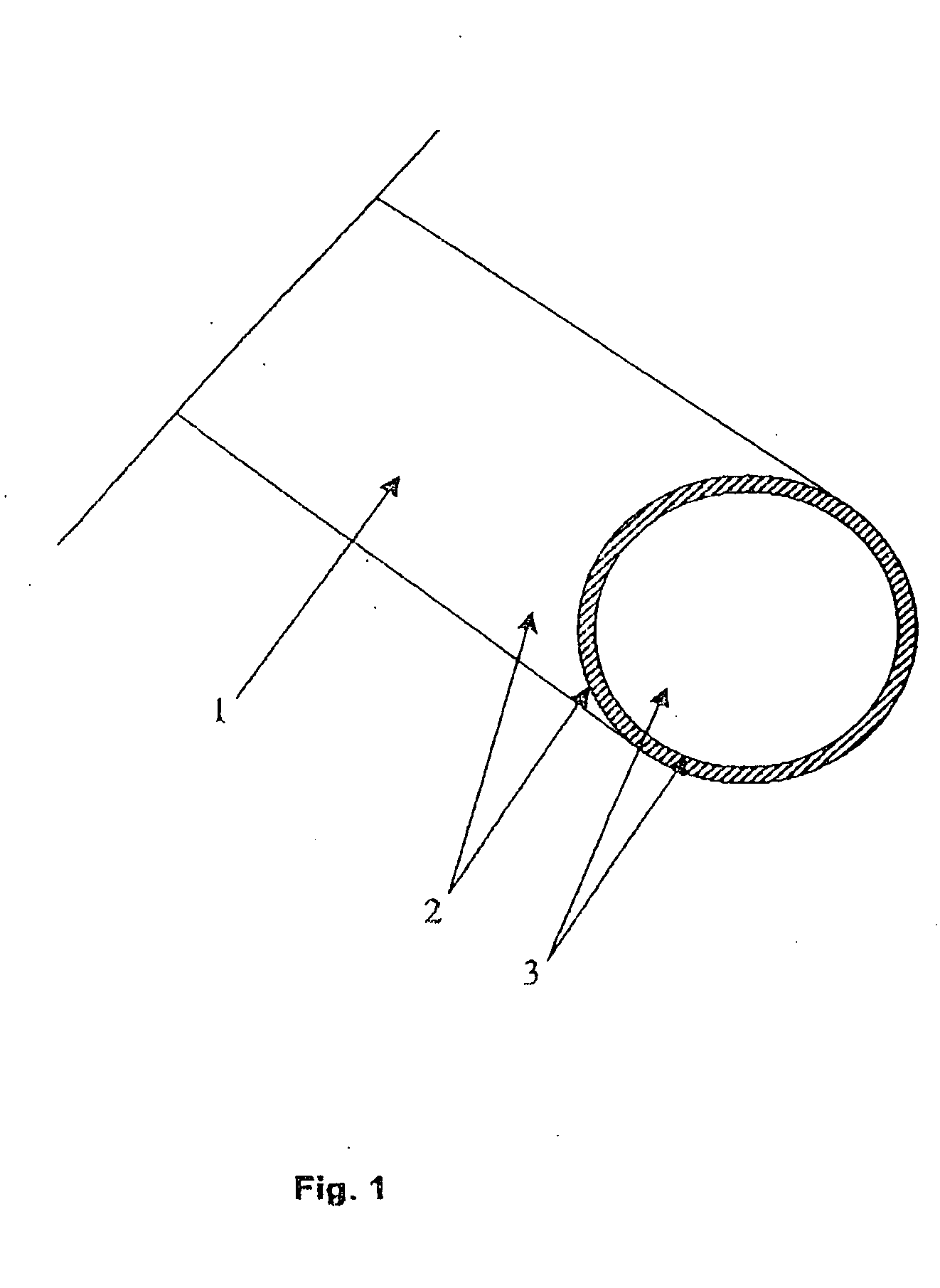 Gastroenterological medical device, in particular stent for the gall or pancreatic duct