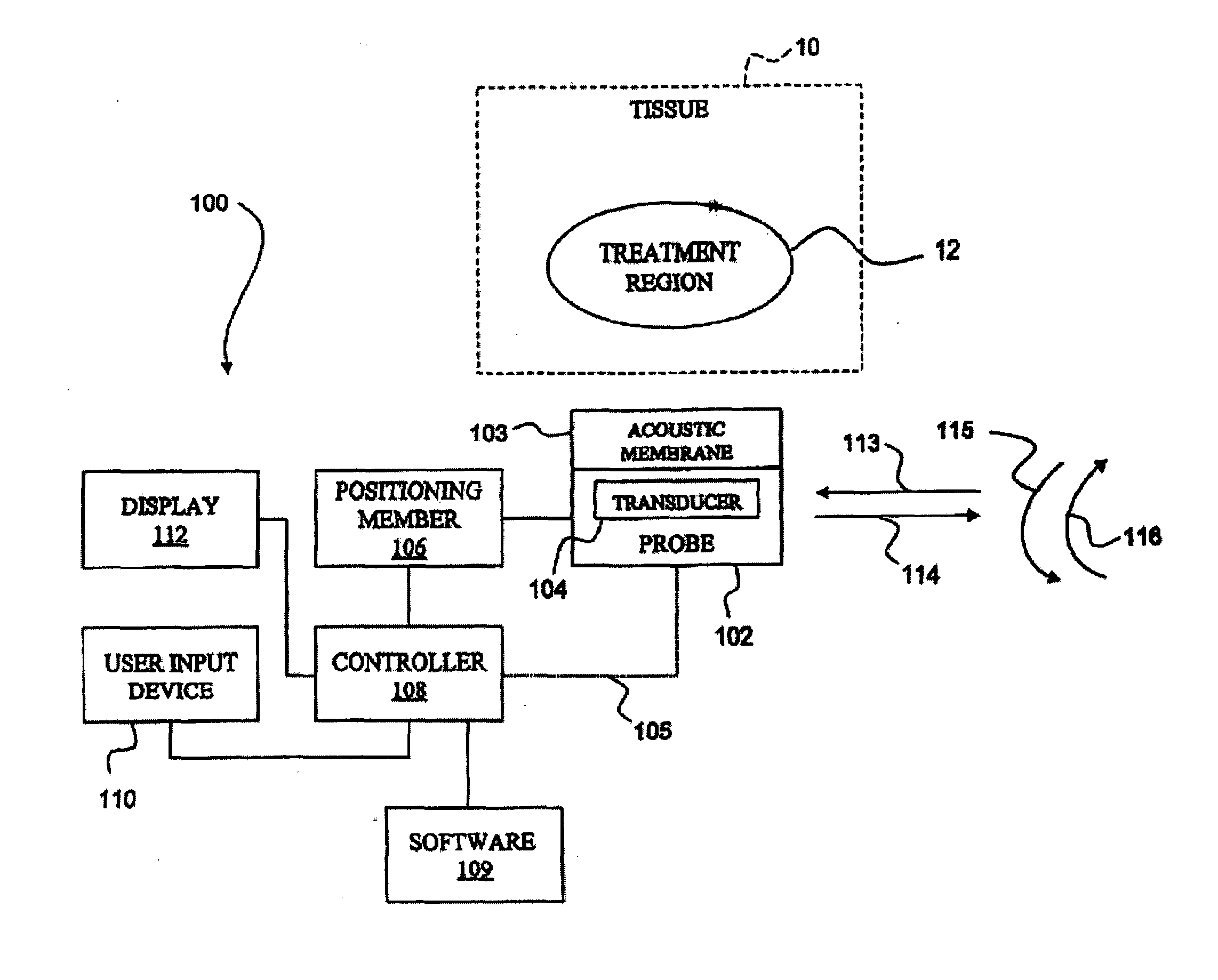 Method of diagnosis and treatment of tumors using high intensity focused ultrasound