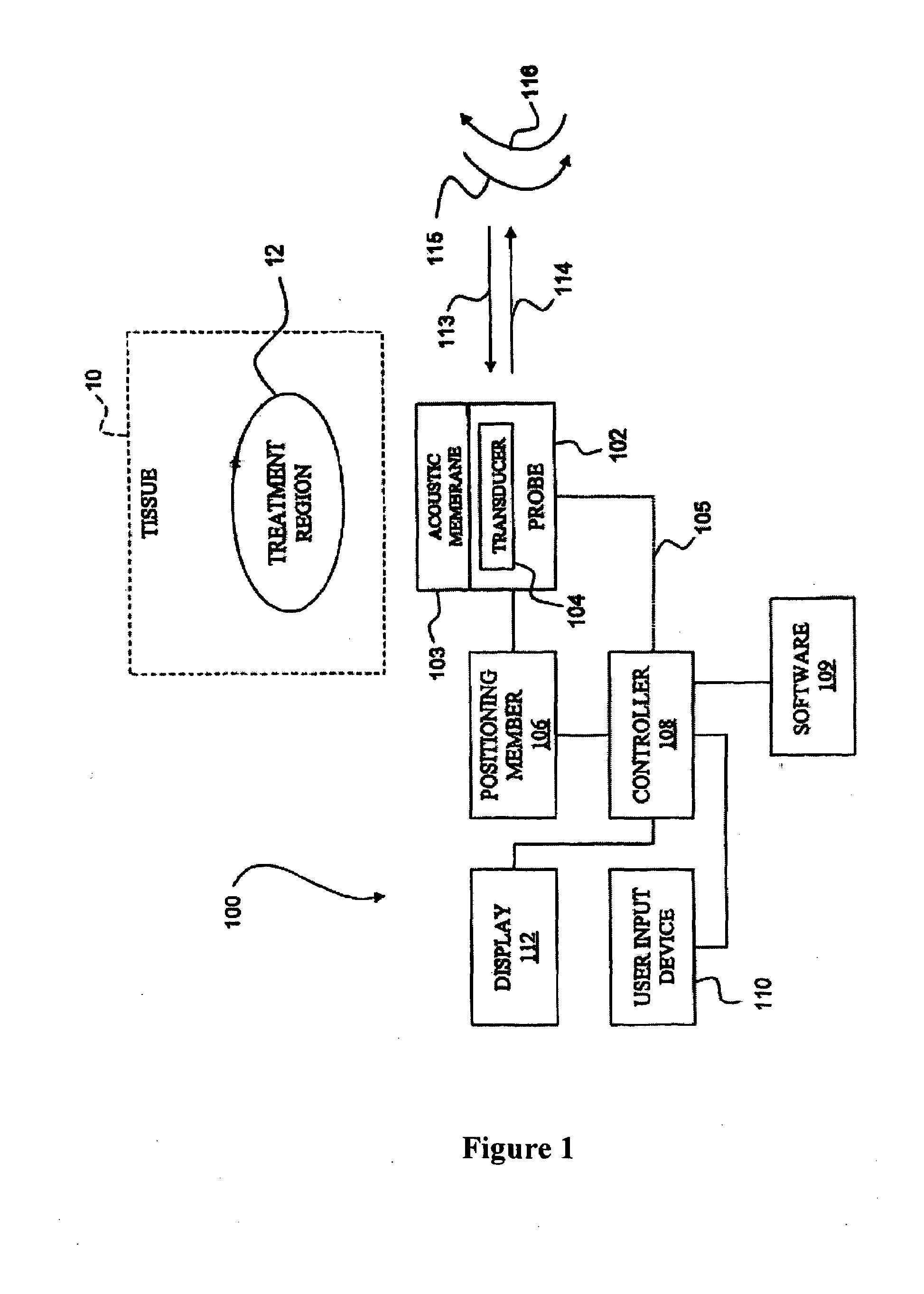 Method of diagnosis and treatment of tumors using high intensity focused ultrasound