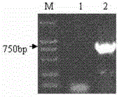 Recombinant vector vaccine expressing HIV antigen