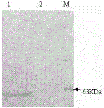 Recombinant vector vaccine expressing HIV antigen