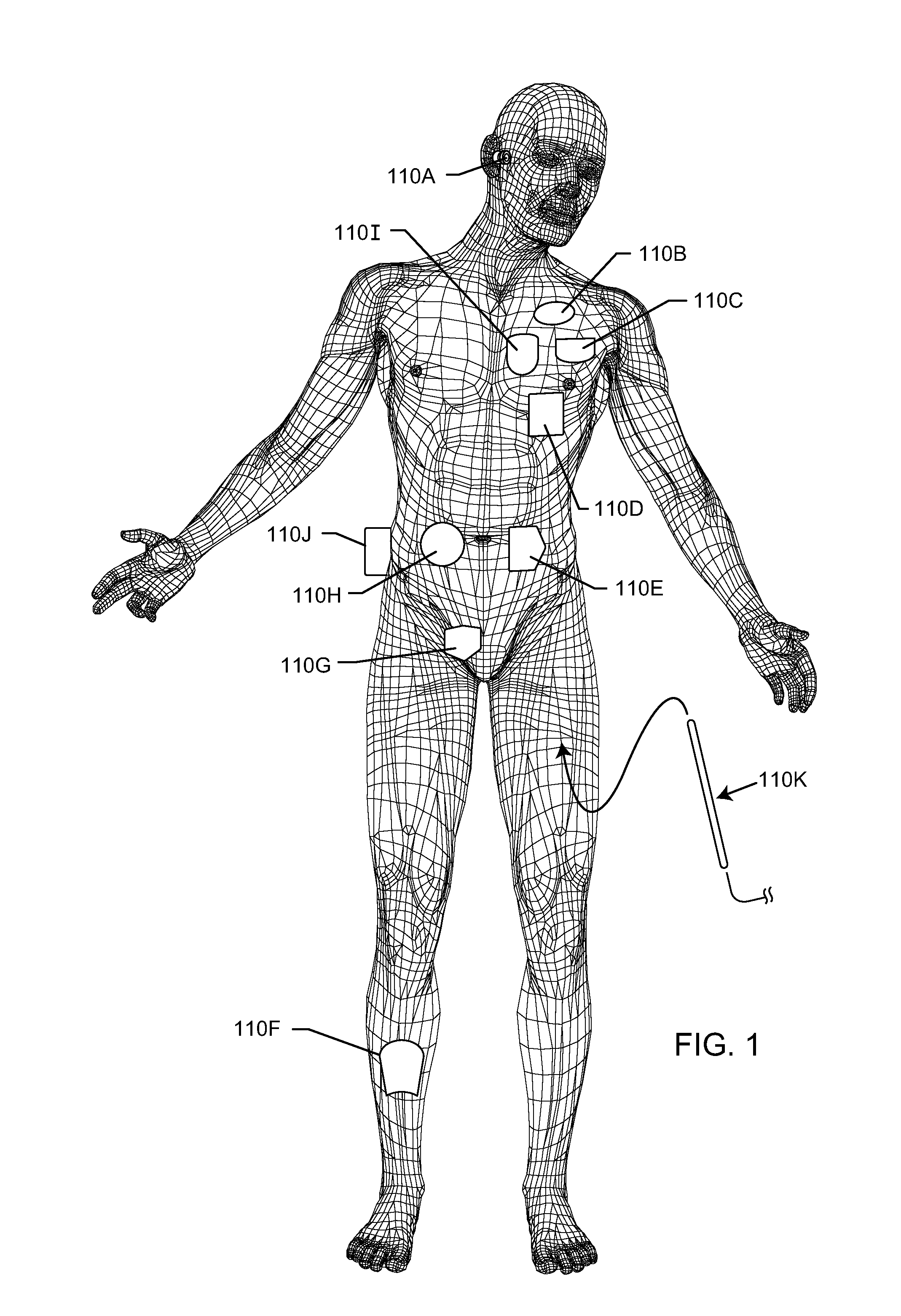 Composite RF current attenuator for a medical lead