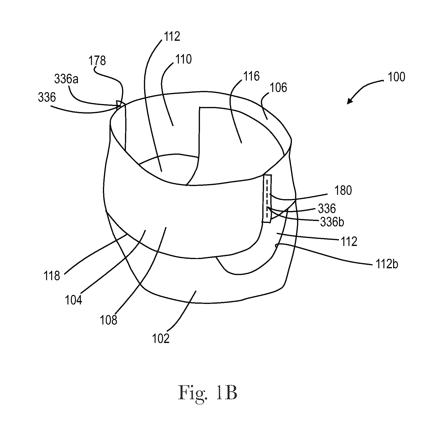 Assembled Absorbent Article Components with Graphics Having Aligned Low Intensity Zones