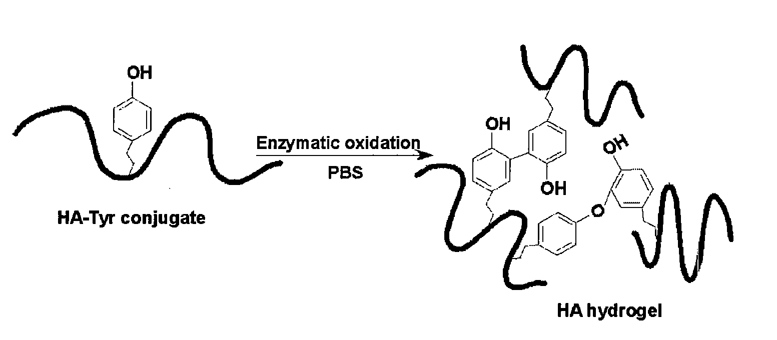 Curable Bone Cement