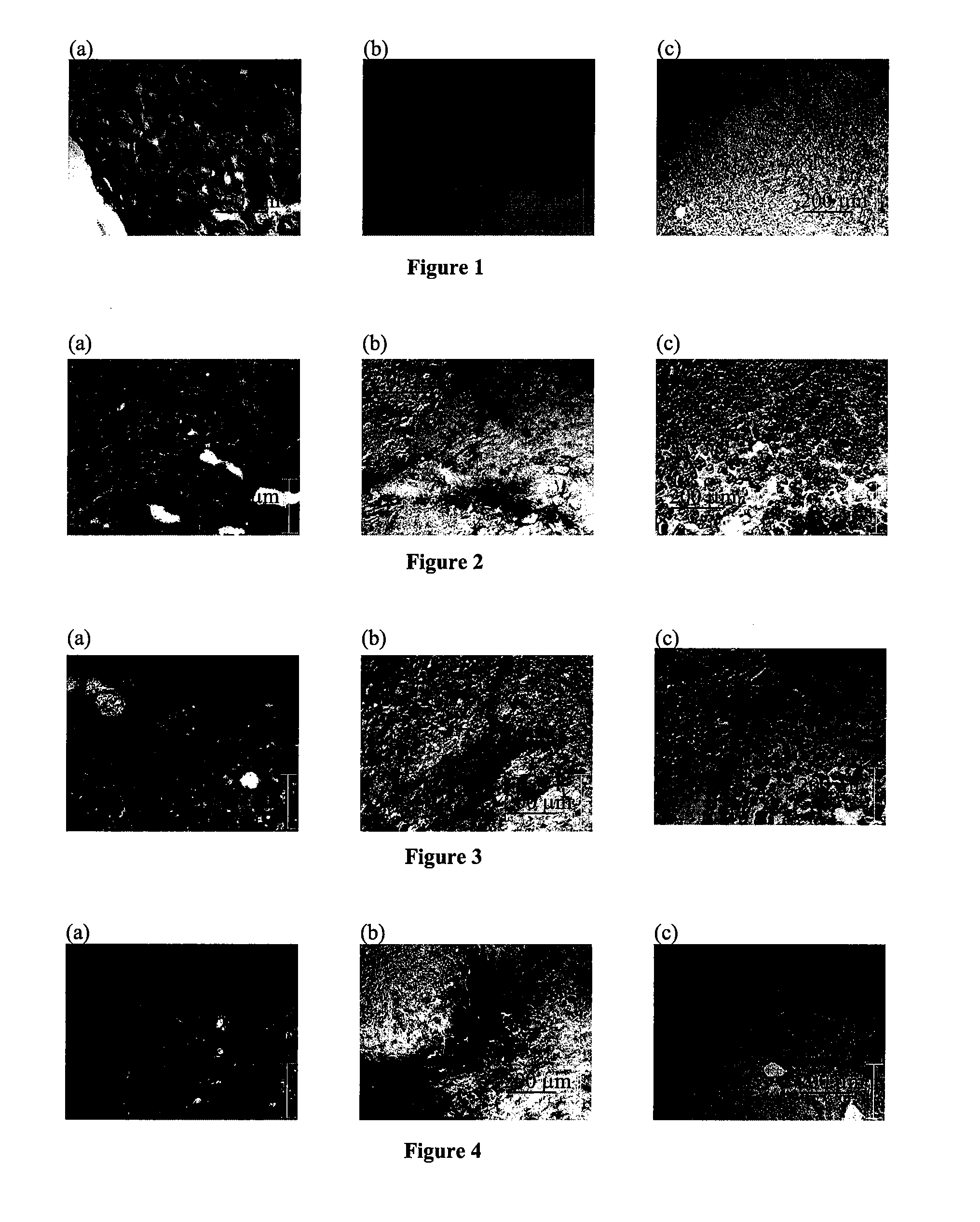 Curable Bone Cement