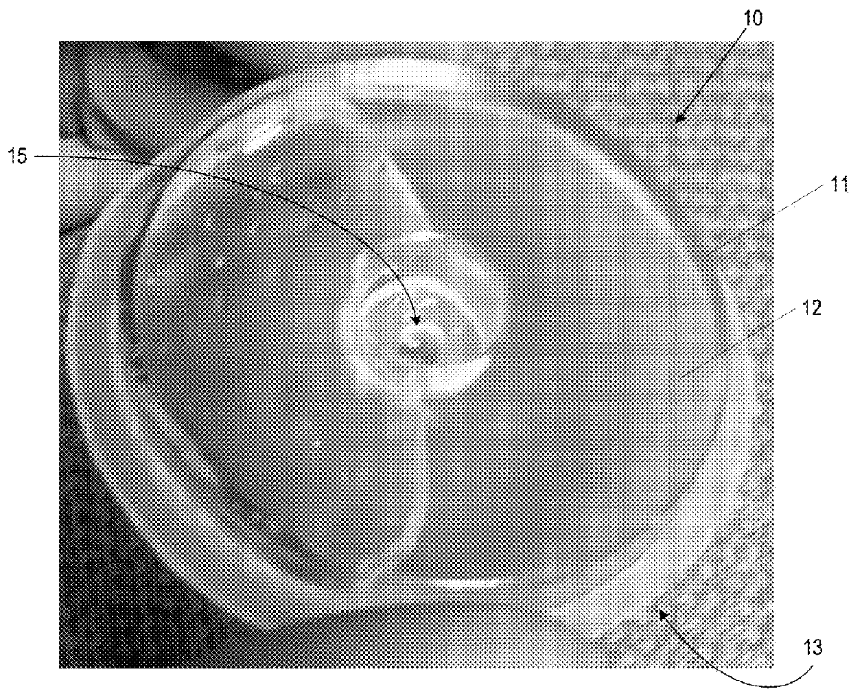 Device for reduction of needle insertion site pain in patients