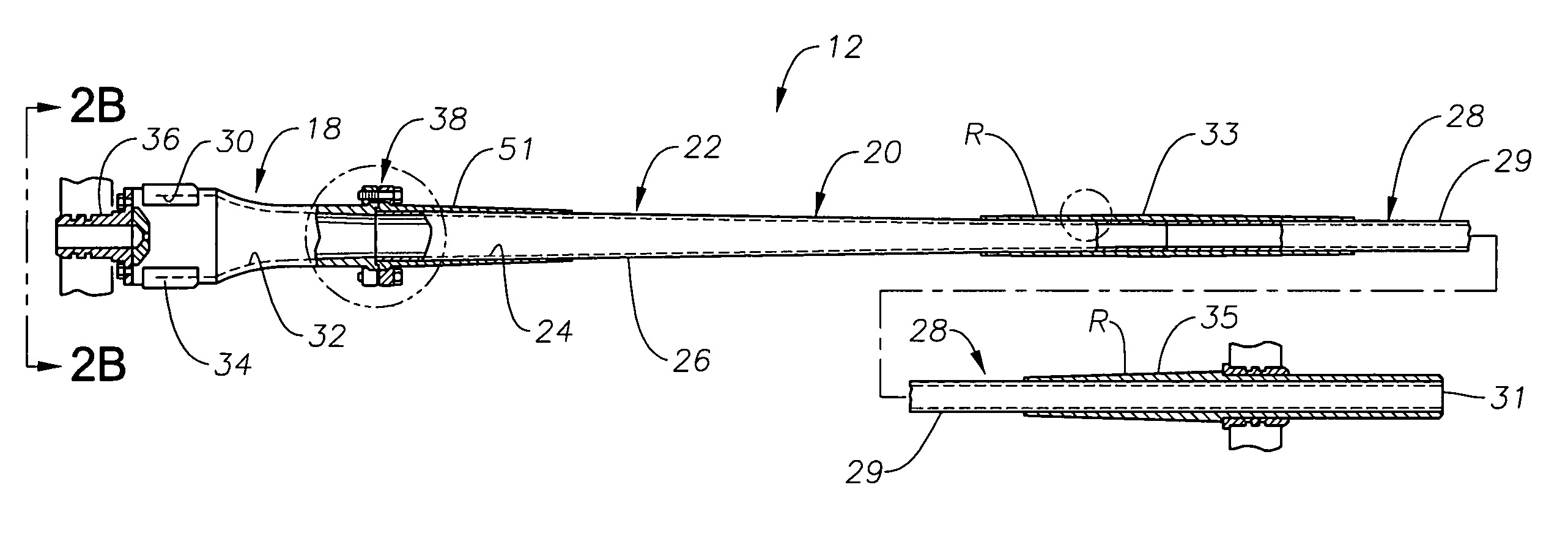 Erosion-resistant hydrocyclone liner