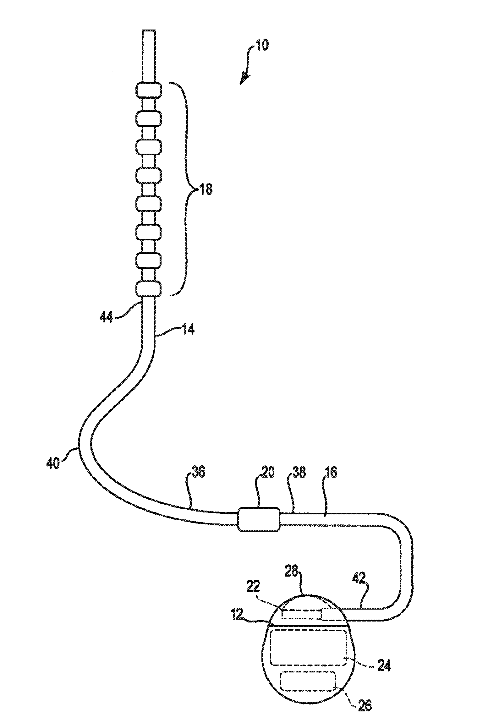 Lead identification system