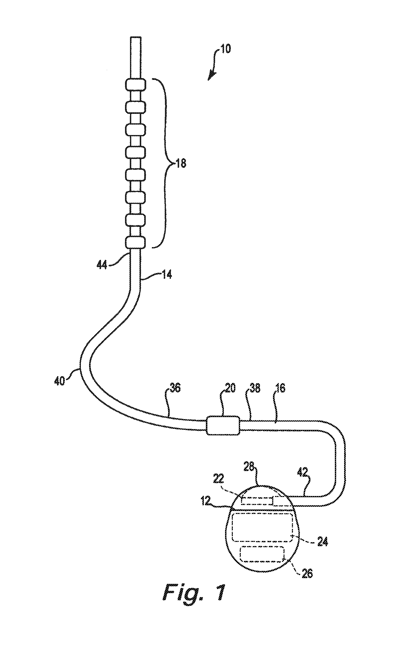 Lead identification system