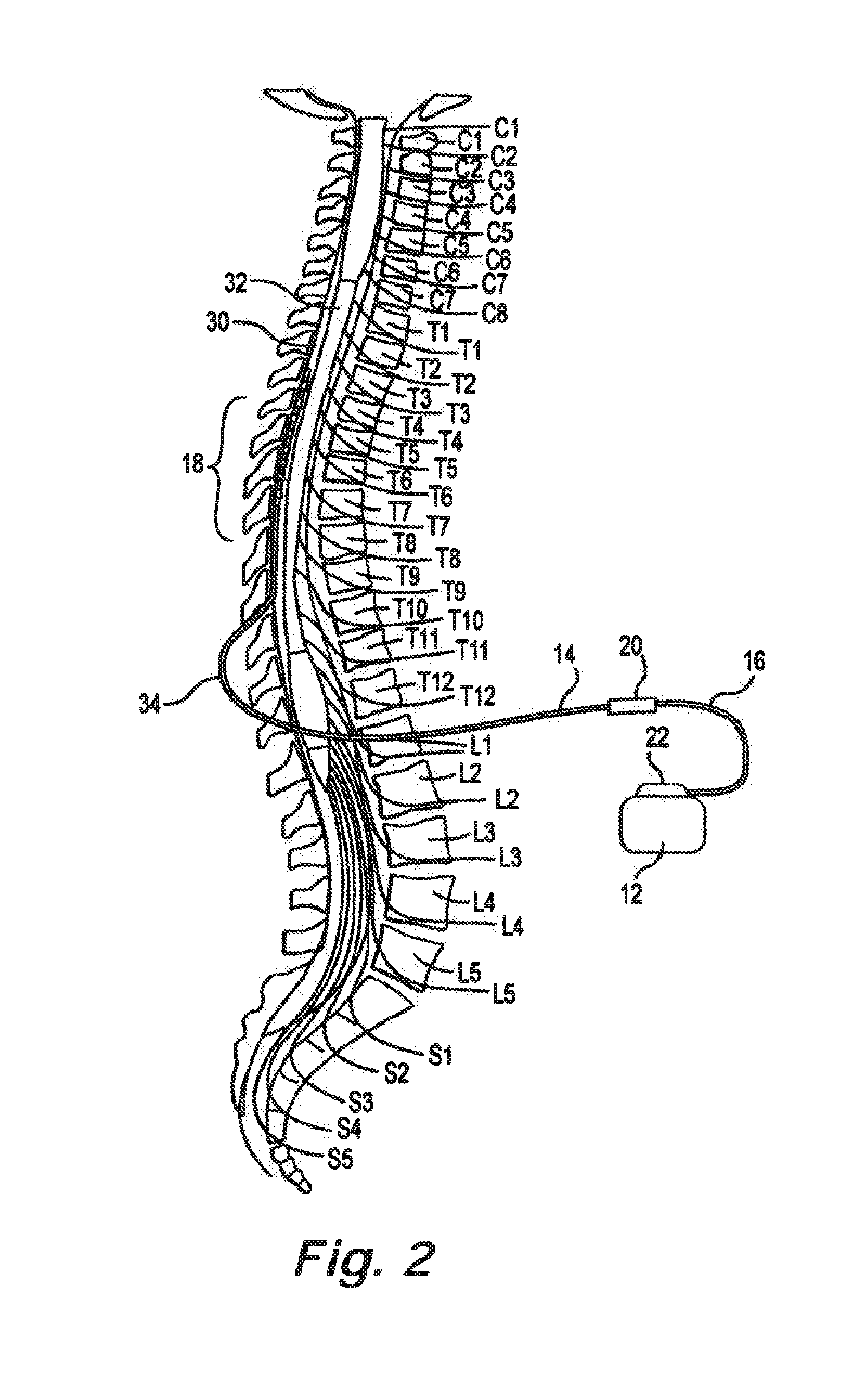 Lead identification system